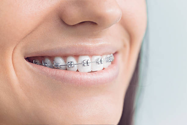 Dental Inlays and Onlays in Esko, MN